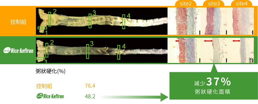Rice Kefiran 克菲素® 可減少37%粥狀硬化的面積